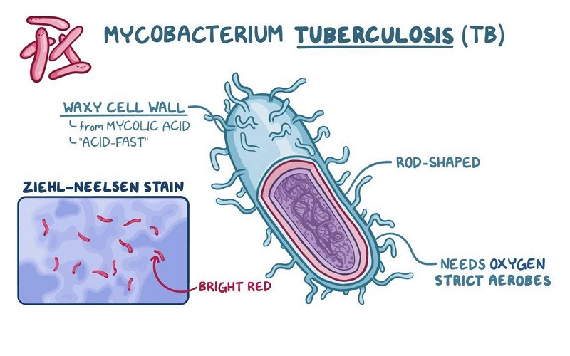 Vi khuẩn lao Mycobacterium tuberculosis